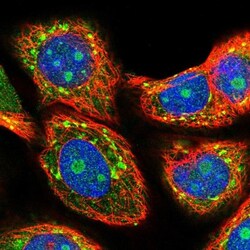 MIF4GD Antibody, Novus Biologicals 25 &mu;L, Unlabeled:Antibodies, Polyclonal